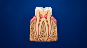 3D anatomical cross-section of a molar tooth showing the nerve and pulp structure that causes tooth pain