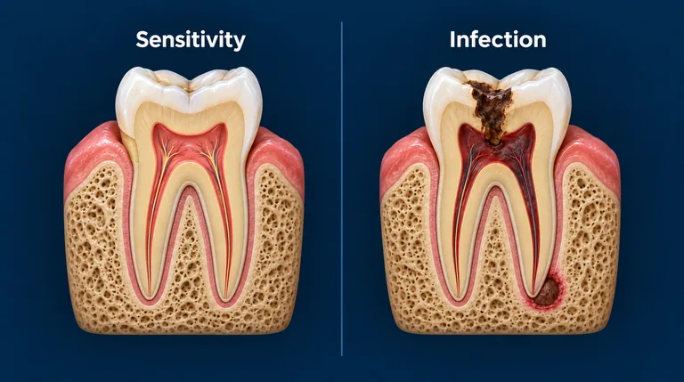 Tooth Sensitivity vs. Tooth Infection: How to Tell the Difference