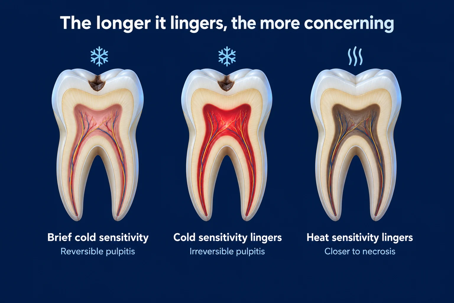 Three molars cut in half on a dark blue background under the title 'The longer it lingers, the more concerning'. The pulp goes from pink to bright red to dark brown. Labels read Brief cold sensitivity, Reversible pulpitis; Cold sensitivity lingers, Irreversible pulpitis; Heat sensitivity lingers, Closer to necrosis.